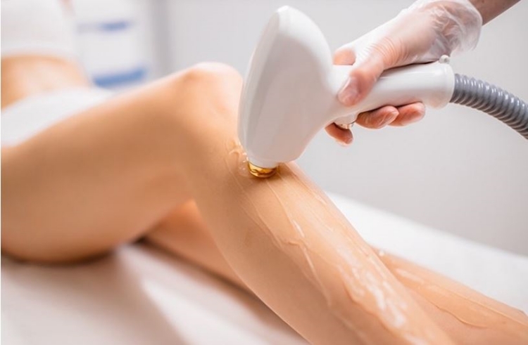 Diode-laser-hair-removal-bodycare (1)