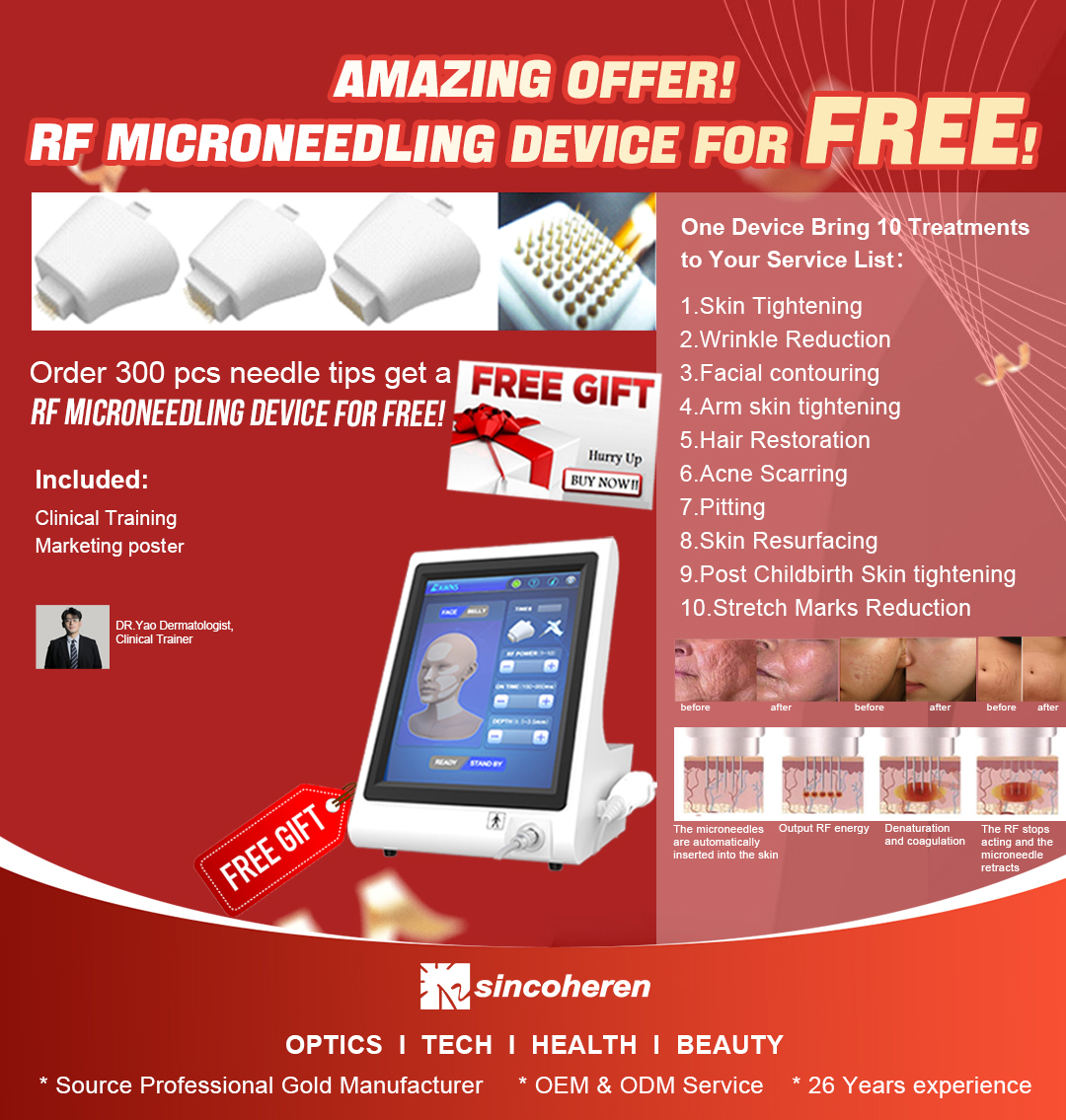 Who should get RF microneedling?