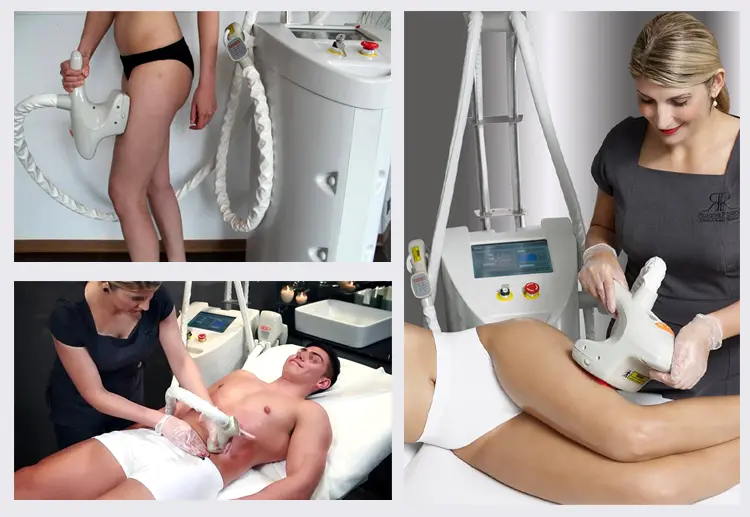 kuma shape rf vacuum massage machine review