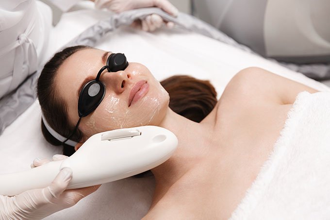 IPL-treatments