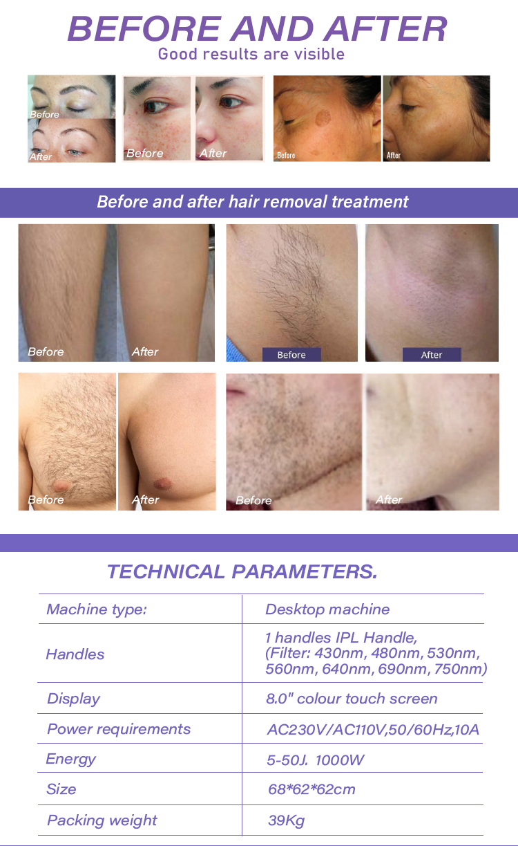 ipl laser machine effect