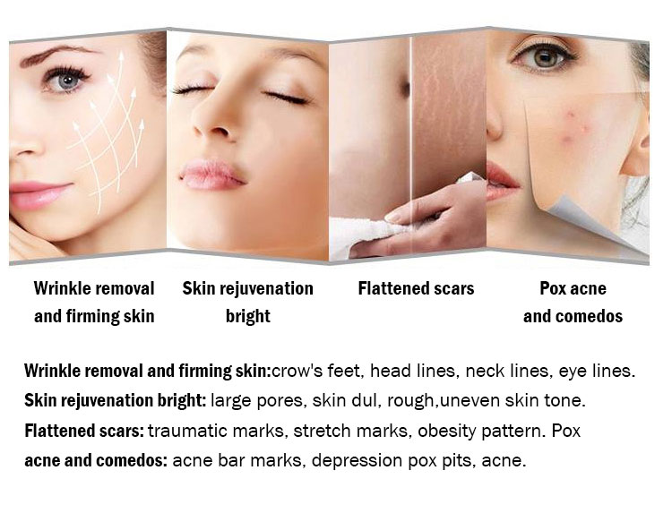 RF microneedling device