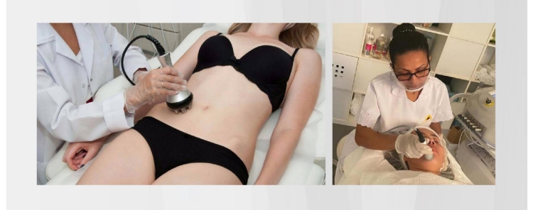 cavitation rf slimming9