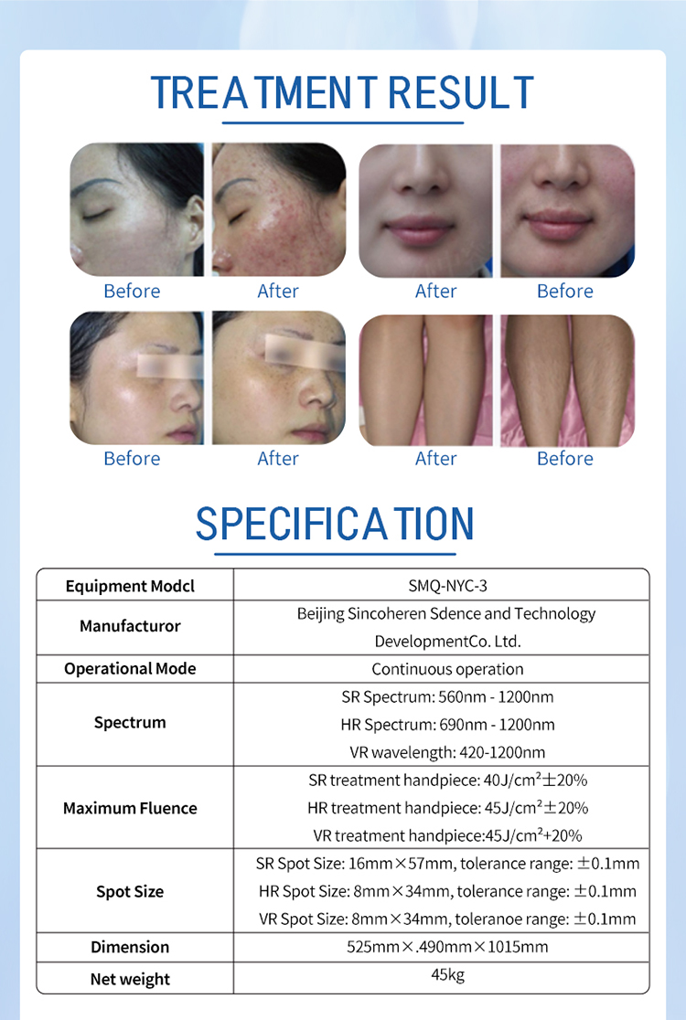 IPL hair remova skin rejuvenation machine06