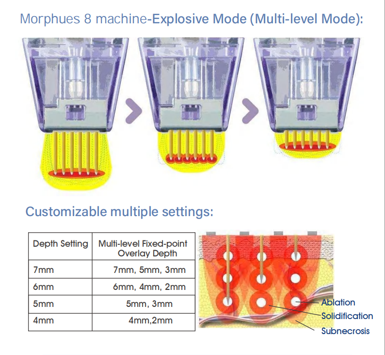 Crystallite Depth 8 machine Working principle-1