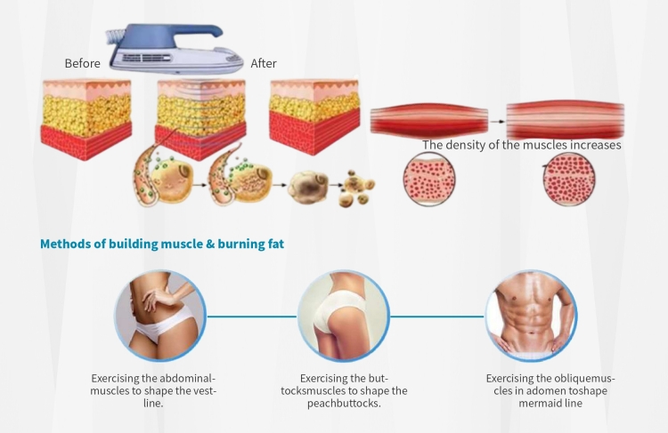 slim sculpting machine3