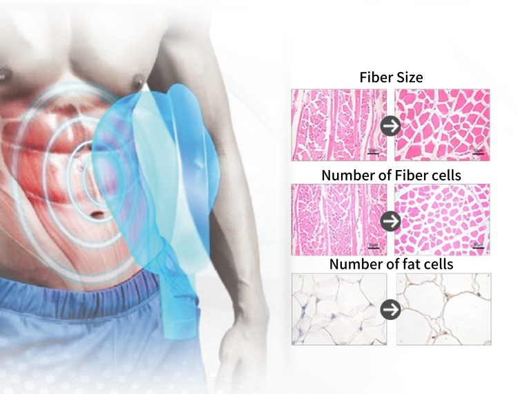 coolpluse ems body slimming machine
