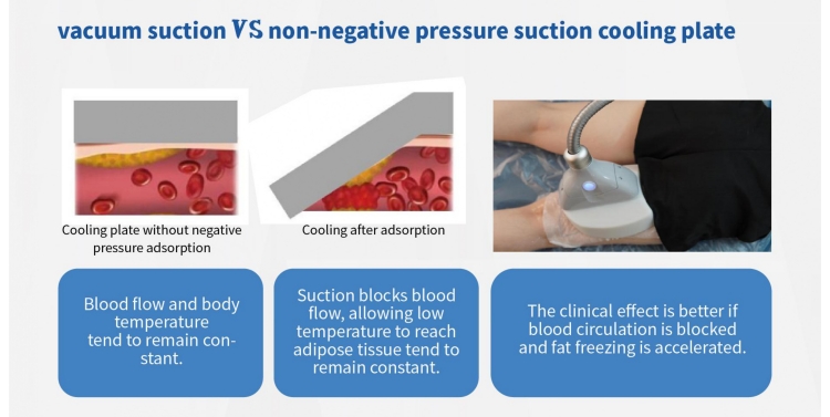 360° coolsculpting cryolipolysis slimming machine advantages