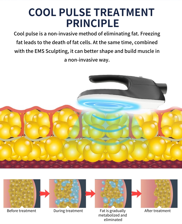 coolpluse ems body slimming machine